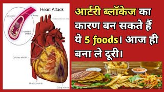 आर्टरी ब्लॉकेज का कारण हो सकते हैं ये 5 foods। पूरी जानकारी हिंदी में। [upl. by Ettenwad158]