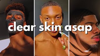 how to get clear skin for guys asap no bs guide [upl. by Samohtnhoj]