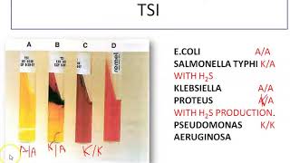 Enterobacteriaceae Family Gram Negative Bacilli [upl. by Ogeid]