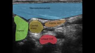 Ultrasound of the Deep Cervical Neck Flexors [upl. by Mick]