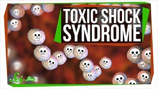 Toxic Shock Syndrome Way Beyond Tampons [upl. by Anirret]