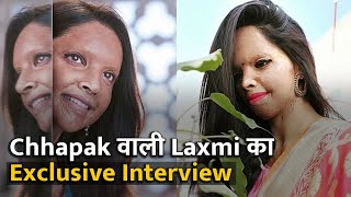 Laxmi Agarwal  Acid Attack के बाद जब पहली बार शीशे में देखा  Exclusive Interview Aaj Savere [upl. by Ameyn]