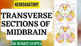 Transverse Sections of Midbrain  NEUROANATOMYTHE BRAINSTEM [upl. by Leroj338]