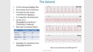 Convolutional neural network for ECG classification [upl. by Joyan]