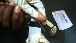 HIV Antibody Test Using A Rapid HIV Card [upl. by Hasile626]