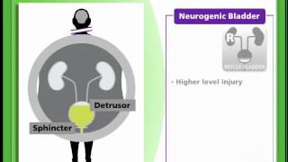 Bladder 13  Neurogenic Bladder [upl. by Beisel]