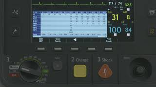 Vital Signs Trending with the HeartStart Intrepid monitordefibrillator [upl. by Pepin]