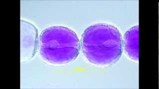 Cytoplasmic Streaming in Tradescantia Stamen Hair Cells [upl. by Schmitt]