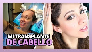 MI TRANSPLANTE DE CABELLO  HAIR TRANSPLANT SURGERY  RosyStoryTime [upl. by Abisha]