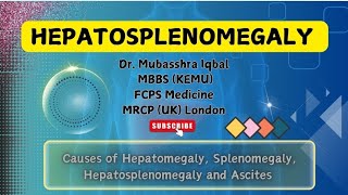 Hepatosplenomegaly Causes  Ascites  Hepatomegaly  Splenomegaly  Short Cases FCPS DrMubasshra [upl. by Kessiah]