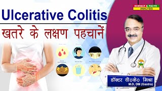 ULCERATIVE COLITIS ख़तरे के लक्षण पहचानें  ASK THE EXPERT HOW SERIOUS IS ULCERATIVE COLITIS [upl. by Milli]