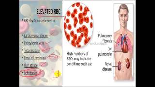 Pathology  dr Nafea  Polycythemia Thrombocytosis امراض الدم [upl. by Lleda]