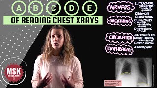 Learning the ABCDEs of Chest Xray [upl. by Hilde]