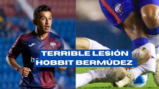 Lesión del Hobbit Bermúdez  Una de las peores en la historia del futbol [upl. by Nalliuq]