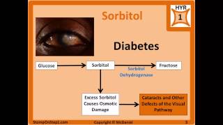 PKU Phenylketonuria Galactosemia Hereditary Fructose Intolerance amp Sorbitol Diabetic Cataracts [upl. by Yrailih]