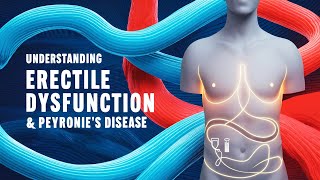 Understanding Erectile Dysfunction amp Peyronies Disease [upl. by Enytsuj]