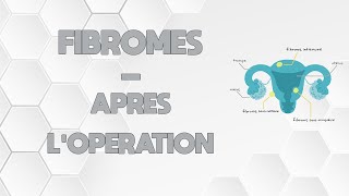 LES FIBROMES  APRÈS L’OPÉRATION [upl. by Winfrid]