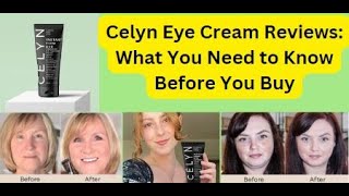 Celyn Eye Cream Reviews what you need to Know [upl. by Annavaig]