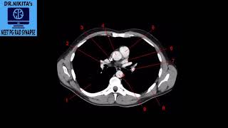 PART2  CT THORAX NORMAL ANATOMY [upl. by Cirdek704]