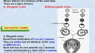 44 General Embryology Twins amp Dizygotic Twins [upl. by Aix702]