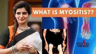 Myositis amp Types How to Treat it With Physiotherapy [upl. by Charisse]