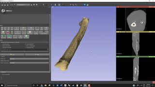 Empezando a usar Slicer 3D para segmentación Médica [upl. by Hamer]