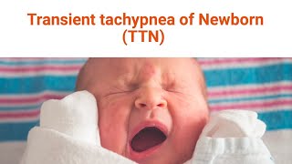 Transient Tachypnea of the Newborn [upl. by Ellehsem]