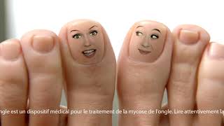 Emtrix® Traitement mycose des ongles ➧ Emtrix des résultats visibles dès la première semaine [upl. by Ahs756]