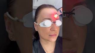 ClearLIft Treatment For Melasma amp Pigmentation  Dr Medispa [upl. by Enneirdna]