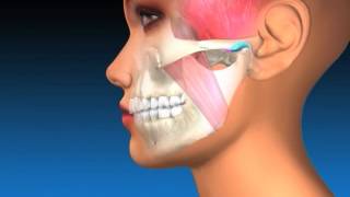 TMJ Explanation amp Therapy [upl. by Tikna517]