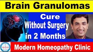 Brain Granulomas lesion  Treatment detail Dr Arpit Chopra Jain  Modern Homeopathy [upl. by Euqinna]