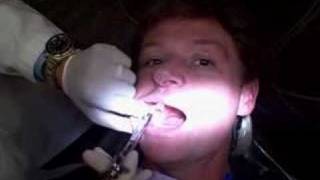 dentist novocaine shot [upl. by Enawtna]