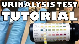 How to Perform a Urinalysis Test with Case Studies  FAST AND SIMPLE  Ohio University [upl. by Ahsirtap]