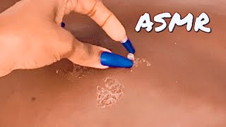 ASMR BIG Skin FLAKES  BACK Scratching and Peeling Sounds [upl. by Atinaujnas]