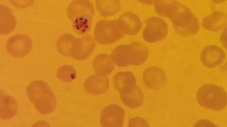 Plasmodium malaria schizont stage [upl. by Rankin]