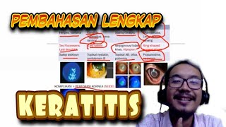 All About Keratitis definisi etiologi gejala pemeriksaan bakterial virus jamur UKMPPD Mata [upl. by Jansen286]