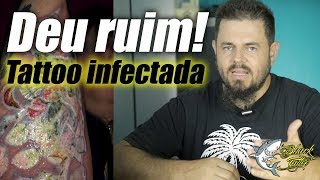 Tatuagem infeccionada [upl. by Sac335]