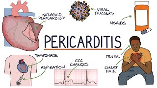 Understanding Pericarditis [upl. by Narih]