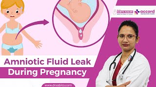 Amniotic Fluid Leak During Pregnancy  प्रेग्नेंसी के दौरान एमनियोटिक फ्लूइड लीक होना  Dr Sabita [upl. by Alel893]