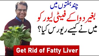 fatty liver symptoms  fatty liver treatment  Detoxify Fatty liver without medicine [upl. by Holland]