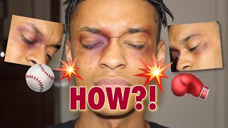 EASY Black Eye Bruised Eye Prank Tutorial  Makeup Monday [upl. by Leontina]