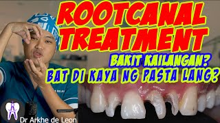 Root Canal Treatment or Therapy Explained ENG CC 51 [upl. by Garry]