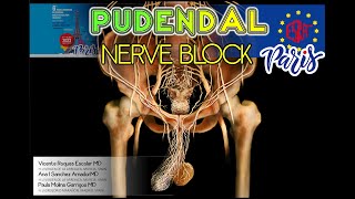 PUDENDAL NERVE BLOCK [upl. by Onimod213]