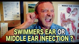 Is it Swimmers Ear or Middle Ear Infection  Pediatric Advice [upl. by Oeflein]