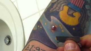 Cutting out my dermal anchor piercing removal at home [upl. by Johnathan115]