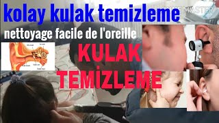 Kulağa kaçan suyu temizleme  denizde havuzda kulak bakımı nettoyage facile de loreille BECERİ TV [upl. by Ordnas]