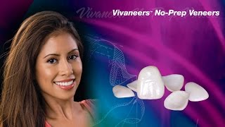 Vivaneers™ NoPrep Veneers [upl. by Eenel]