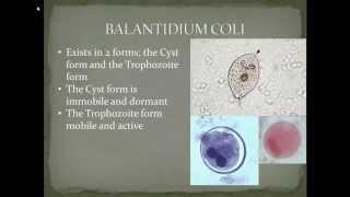 Parasitology Balantidiasis Part 2 [upl. by Myer]