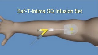 How to Insert SafTIntima™ SQ Infusion Set [upl. by Ahsiema952]