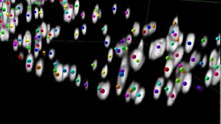 Herpesvirus Infection Increases Peroxisome Numbers [upl. by Allister]